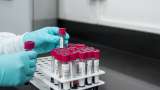 New blood test that can detect 50 different types of cancer shows progress