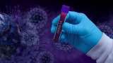 COVID-19 Update: India records 237 new coronavirus cases, infection tally stands at 4.50 crore